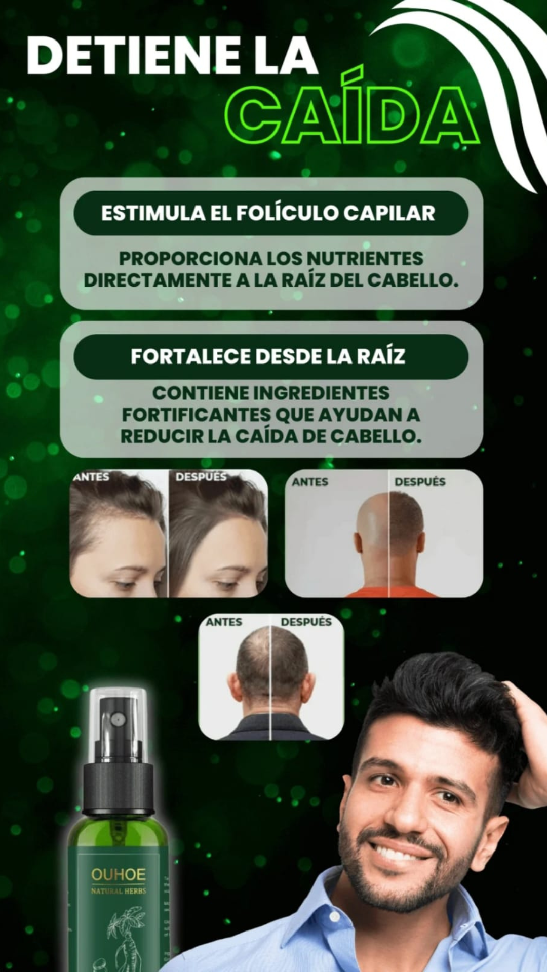 ELOHE HAIR -CRECIMIENTO DE CABELLO